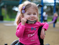 Criança com Osteogenesis Imperfeita